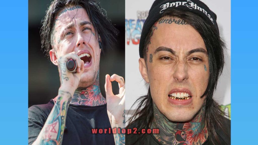 Ronnie Radke bio wiki facts