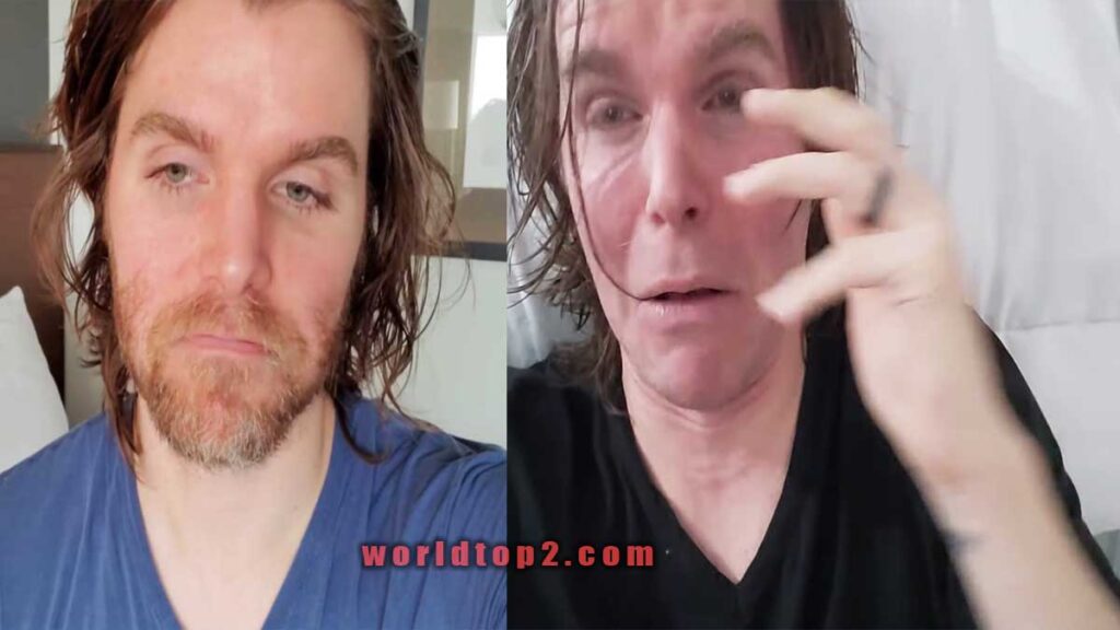 Onision bio wiki facts