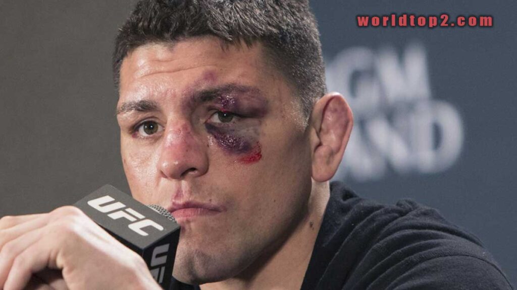 Nick Diaz net worth