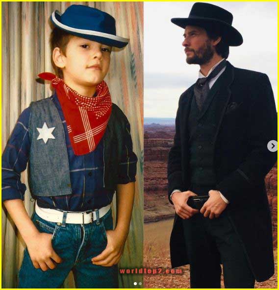 Ben Barnes before and after