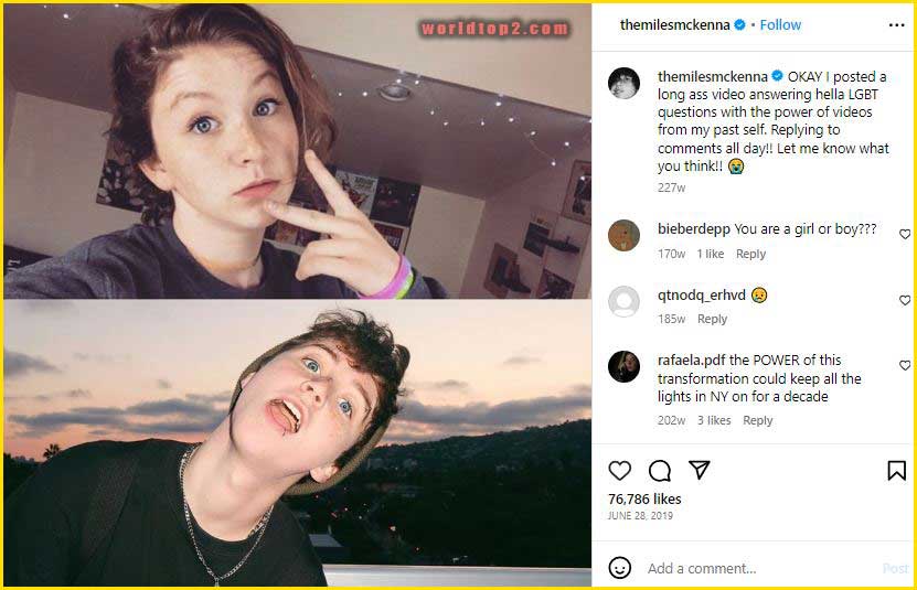 Miles Mckenna before and after